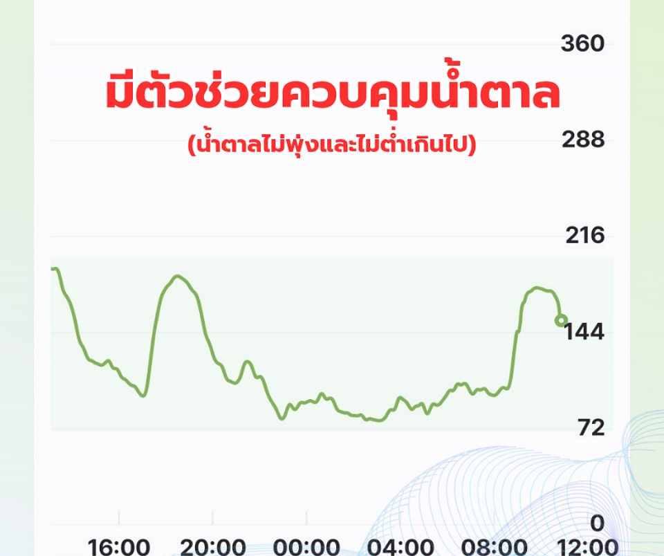 ระดับน้ำตาลในเลือดจาก CGM